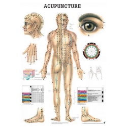 Akupunktúra